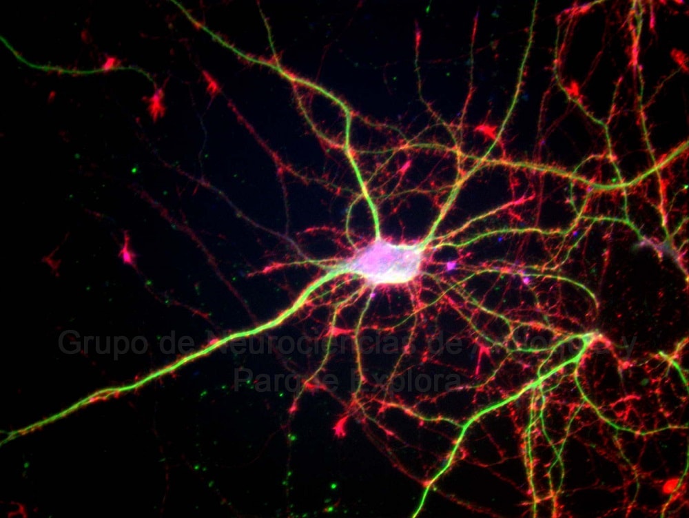 10.Neuronas_MAP2_Factina2-min